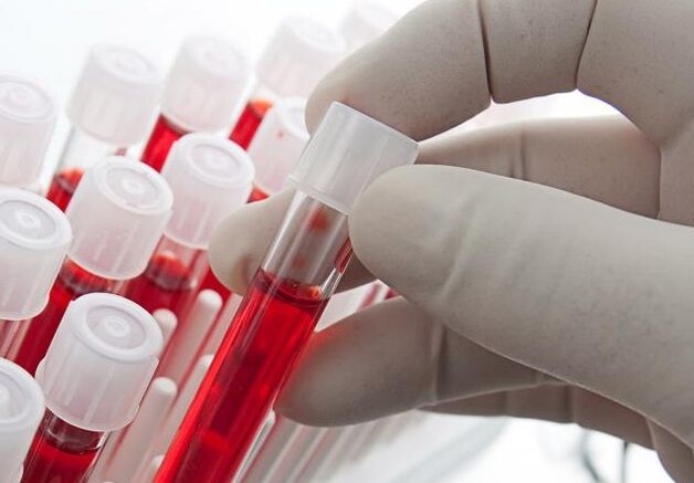 Análise de sangue despois de beber alcohol